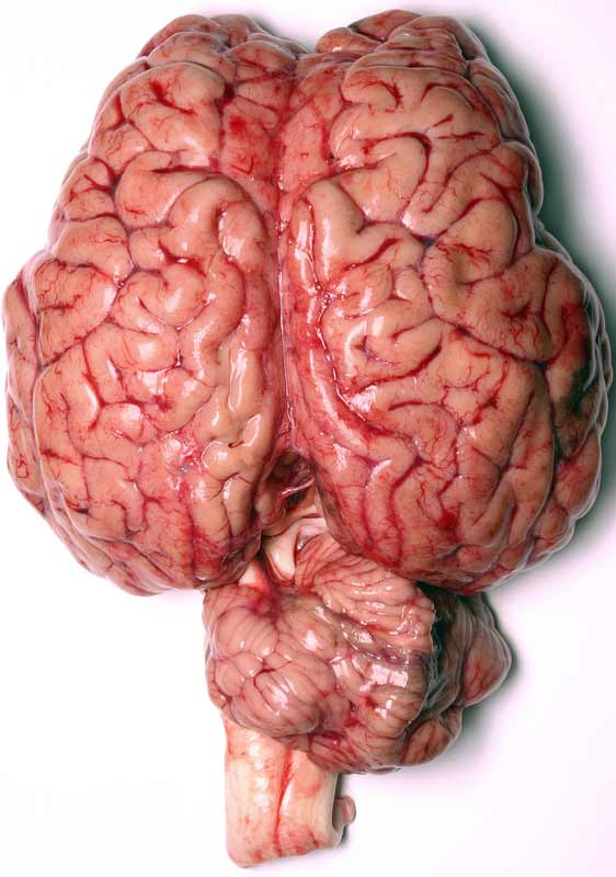 the real human brain
