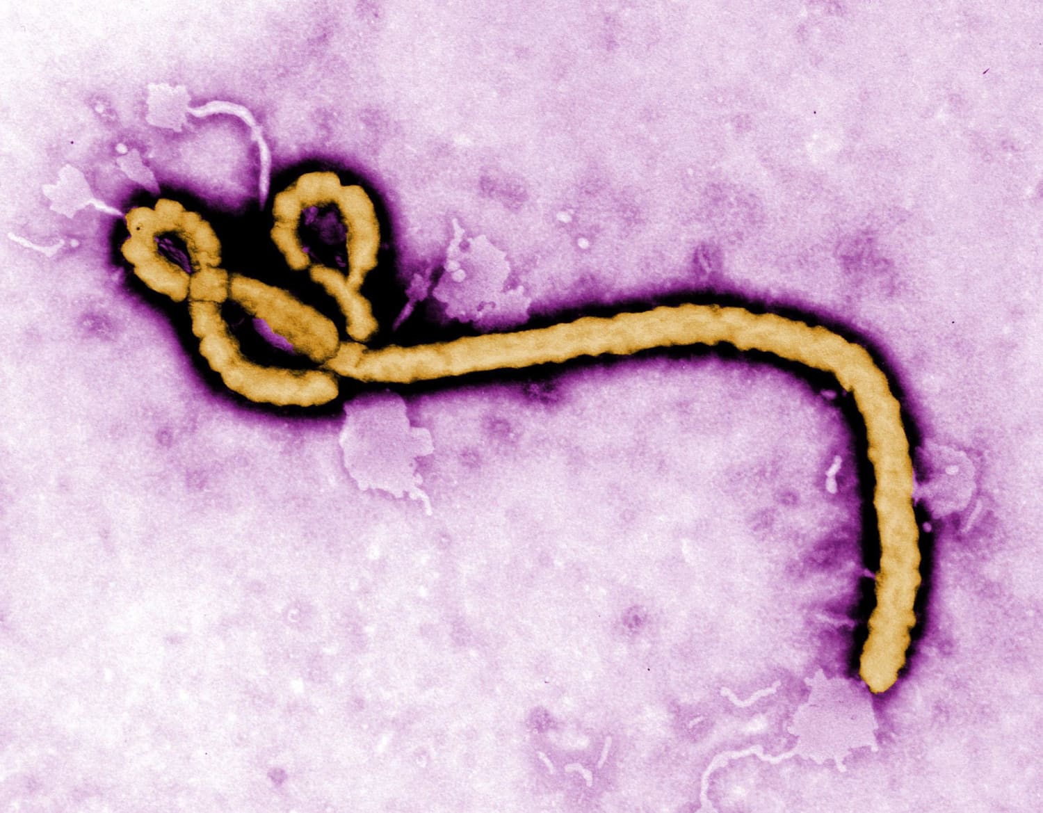 Close to Home: First Case of Ebola Diagnosed in U.S., CDC Confirms.