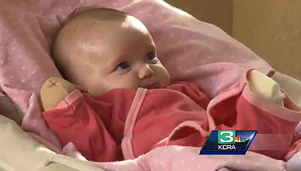 Baby's Rare Disease Makes Hugging Too Dangerous - NBC News
