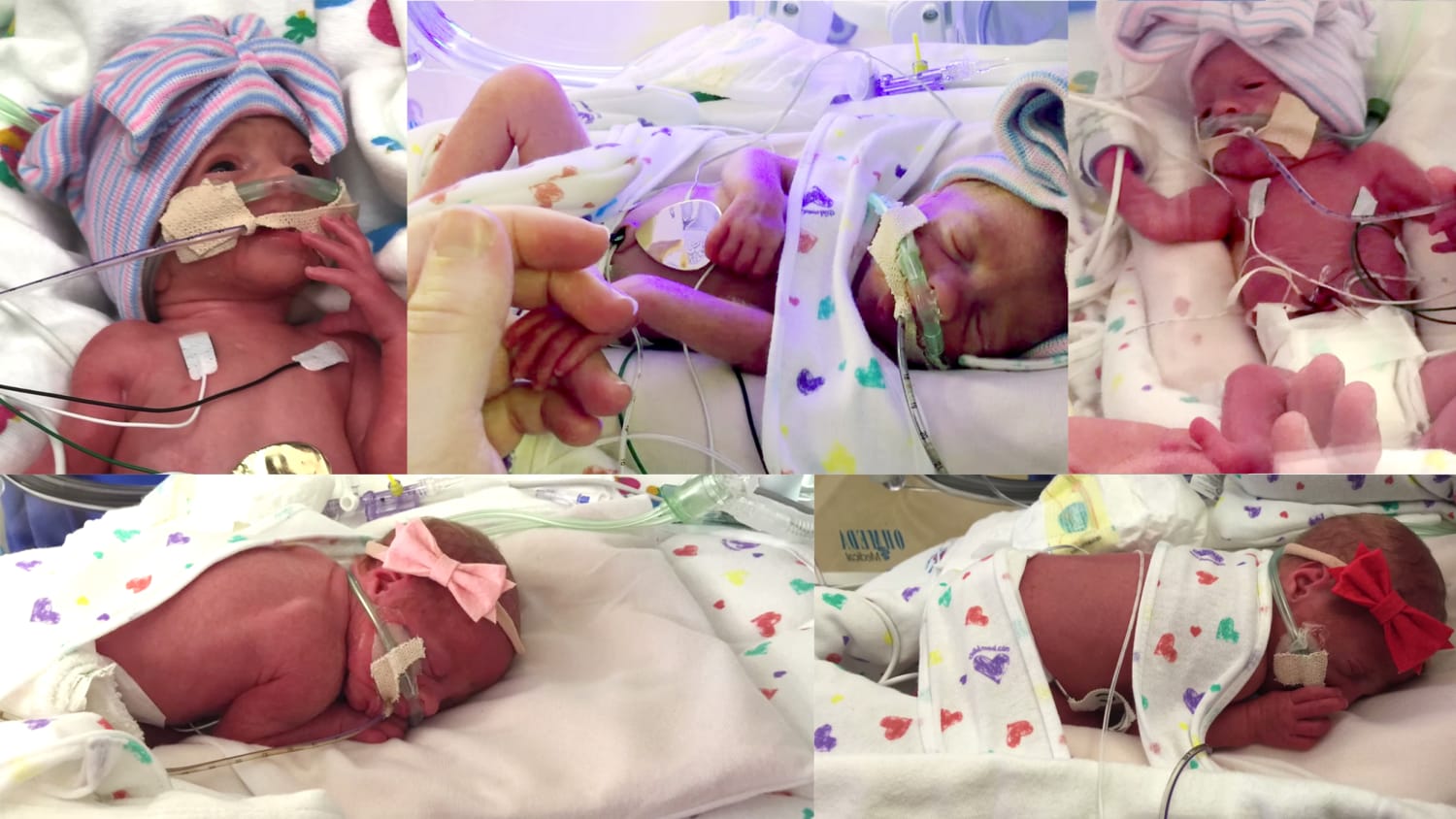 Mom of all-girl quintuplets describes holding babies for first time