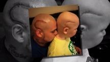 Dad gets tattoo to match son's cancer scar