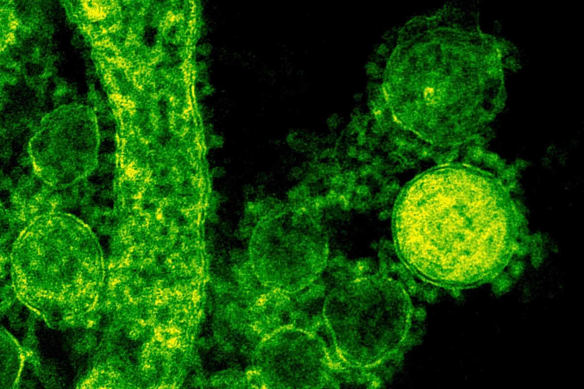 MERS Spreads to China from Korean Outbreak - NBC News1200 x 800