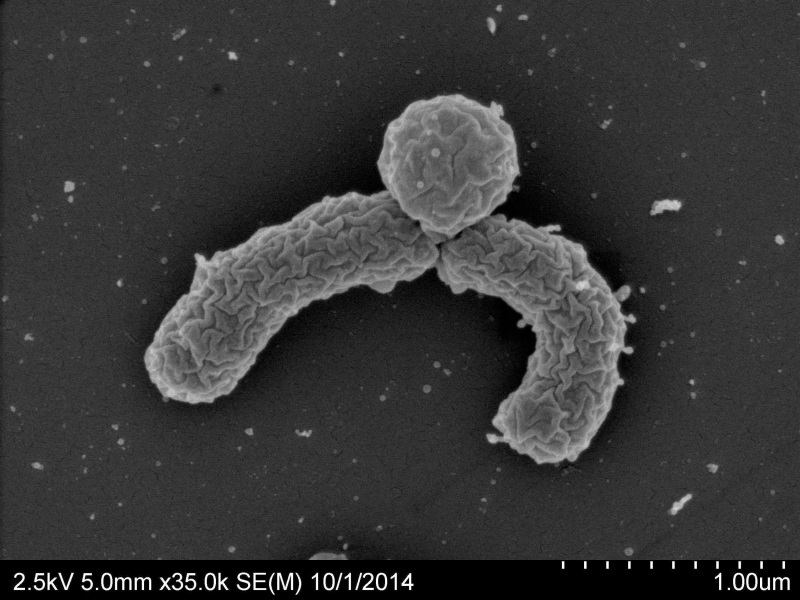 Image: Eleftheria terrae, a newly discovered soil bacterium dug up in a Maine field, has yielded a potentially powerful new antibiotic. 