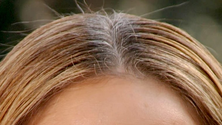 Grey hair roots