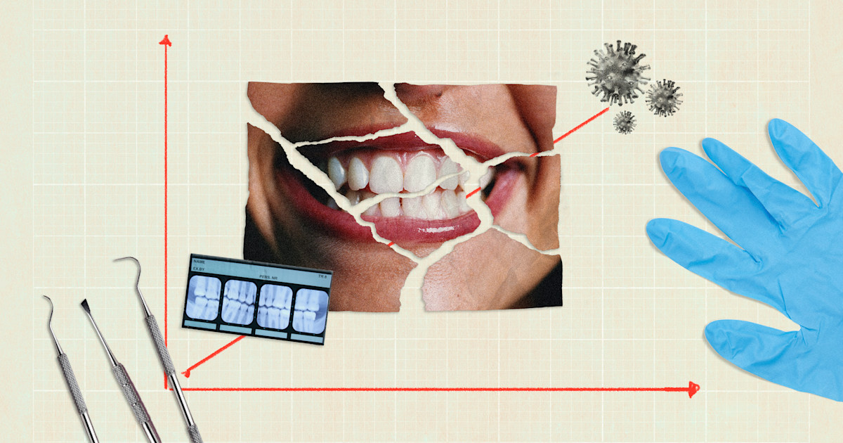 teeth-grinding-and-other-dental-damage-is-increasing-during-the-pandemic